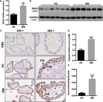 Upregulation of RND3 Affects Trophoblast Proliferation, Apoptosis, and Migration at the Maternal-Fetal Interface